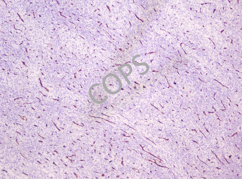 Immunohistochemistry