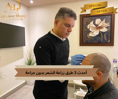 أسعار زراعة الشعر بالسعودية