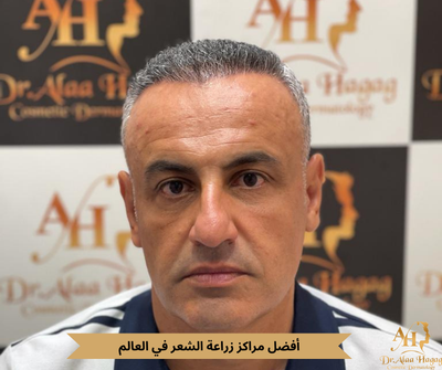 أفضل مراكز زراعة الشعر في العالم