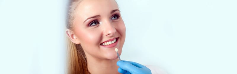 Veneers
