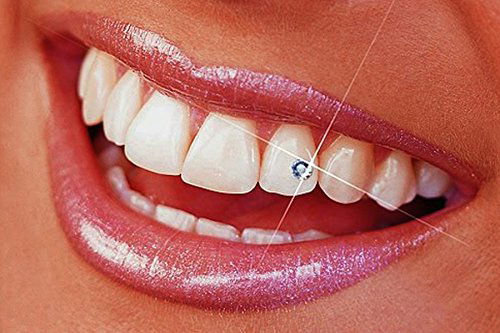 Dental Jewellery