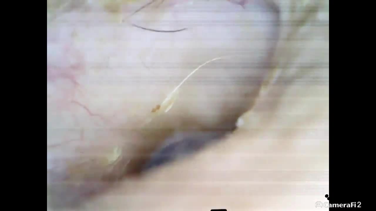 Ear Drum with Camera at Niugini Medical Services Lab