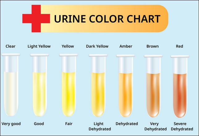 Urine Test