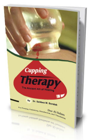 Cupping Therapy- The Ancient Art of Healing