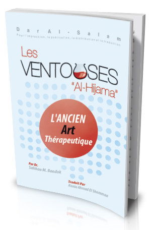 Le traitement par ventouses “Al- Hijama”