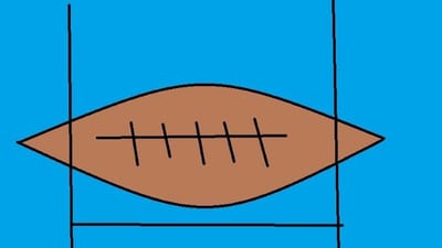 Noise Creates Problems Following a Concussion