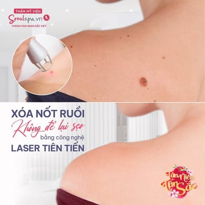 cong nghe tay not ruoi hien dai