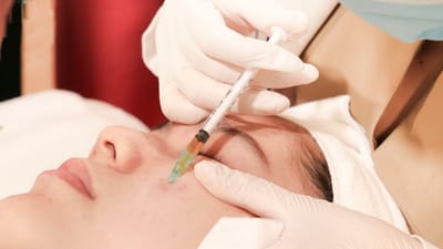 ai nen thuc hien tiem meso