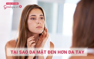 Tai sao da ma den hon da tay