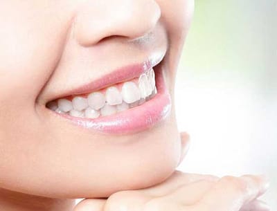 Basal Implants in Ahmedabad