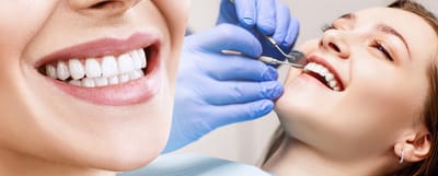 Wisdom Teeth Whitening in Ahmedabad