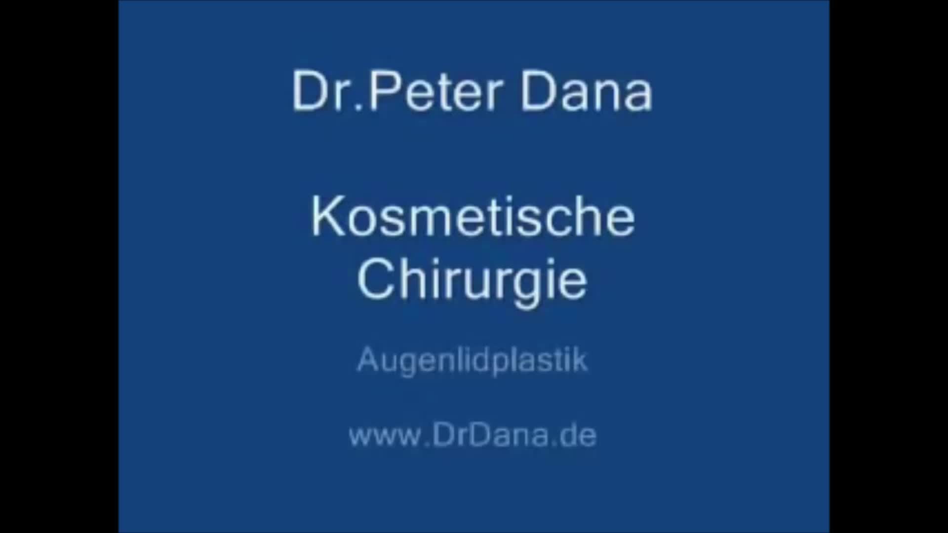 Blepharoplasty - Augenlid OP video thumbnail