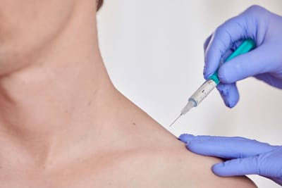 Akupunktur   image