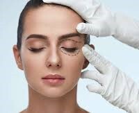 Blepharoplasty - Augenlid OP image