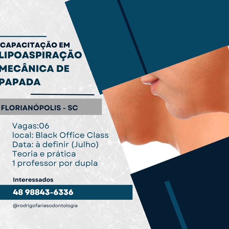 capacitação em Lipoaspiração mecânica de papada