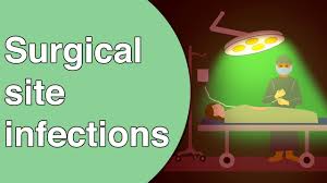 39th Journal Article