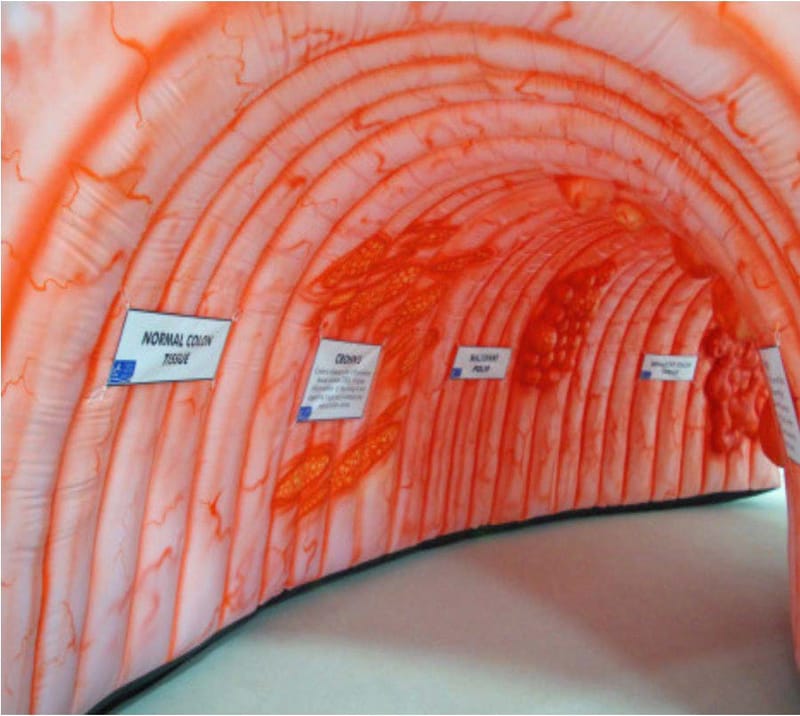 Colorectal Cancer Awareness