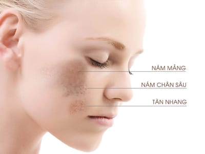 Cach de nhan biet nam va tan nhang nhanh nhat