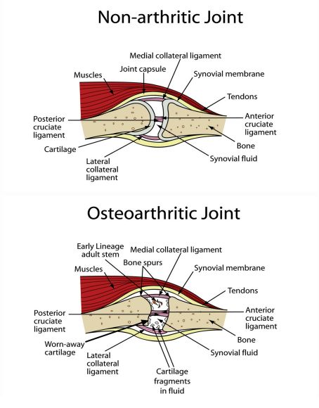 Medical Illustrations