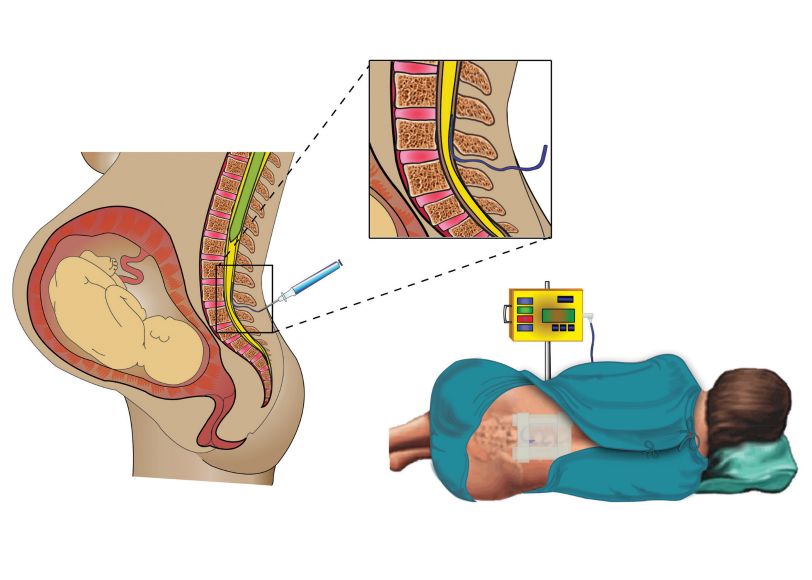 Medical Illustrations