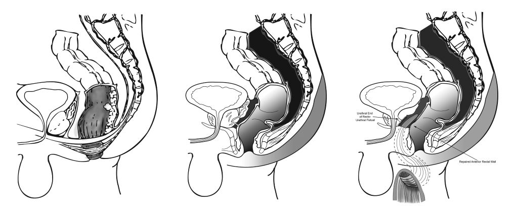 Medical Illustrations