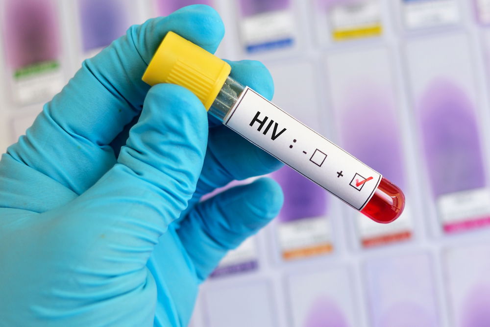 وسواس Hiv الإيدز!