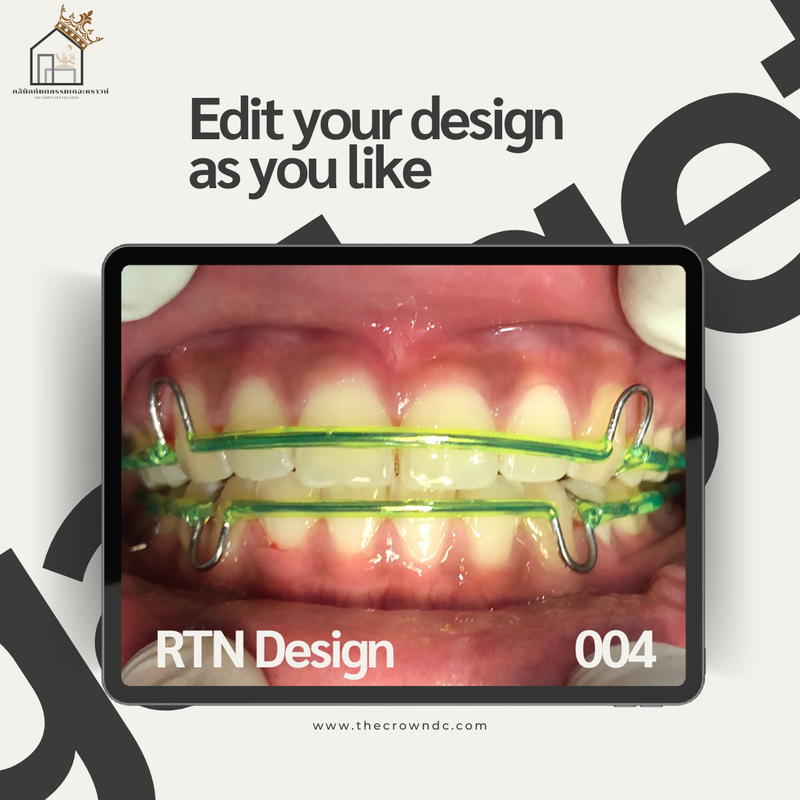 Retainers Shades & Design