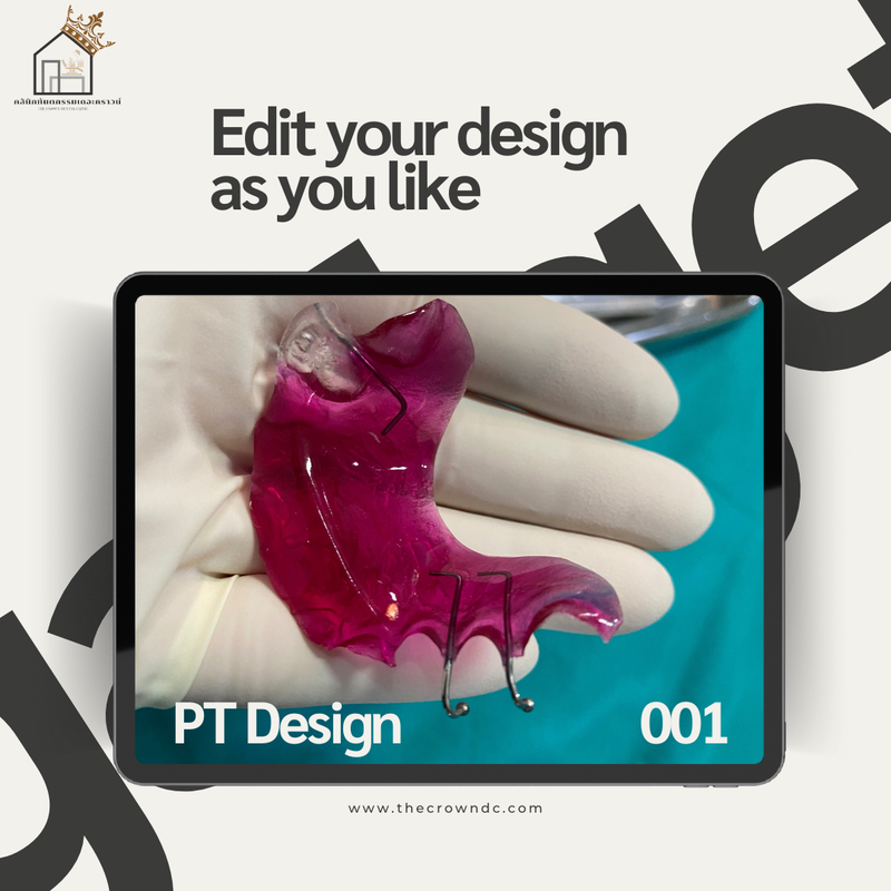 Orthodontic Plates Design