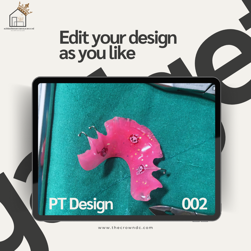 Orthodontic Plates Design