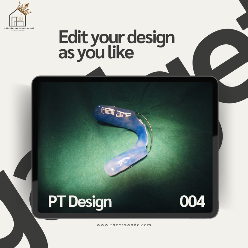 Orthodontic Plates Design