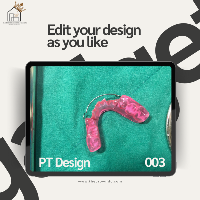 Orthodontic Plates Design