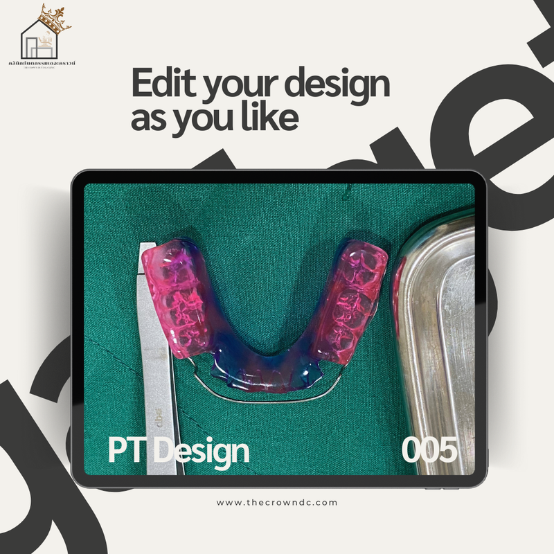 Orthodontic Plates Design