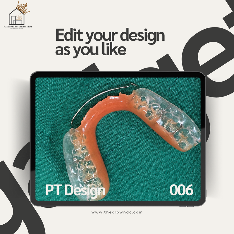 Orthodontic Plates Design