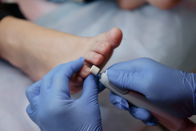 Frequently asked questions about (tavaborole) Kerydin Topical Solution