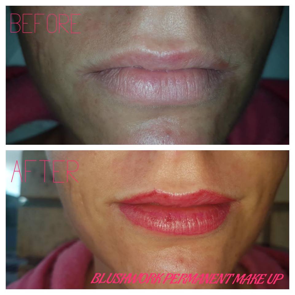 Before and After care for Lips