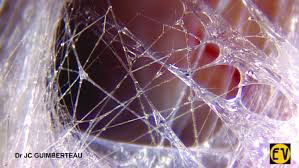 Why keep your fascia healthy?