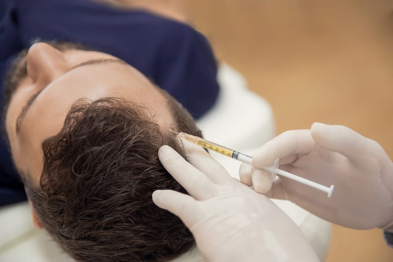 Microneedling / Mesotherapy Scalp