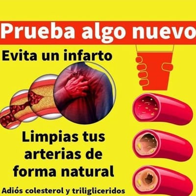 Colesterol y Trigliceridos
