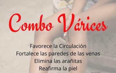 Varices y problemas de circulación