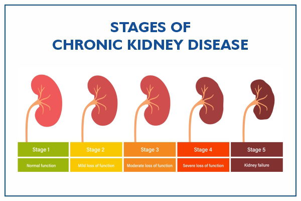 HOME REMEDIES FOR KIDNEY DISEASE