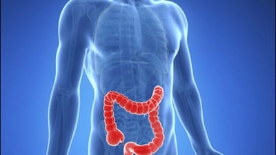 what is the difference between IBS and IBD