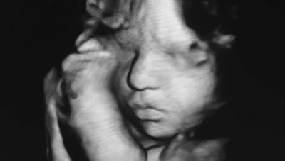 Ecografie in gravidanza