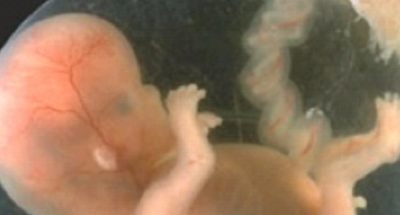 Gravidanza: dalla 9ª alla 12ª settimana