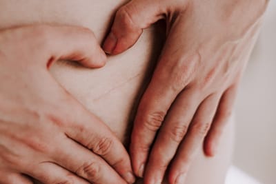 Mit tanultam Én a császármetszésből?!