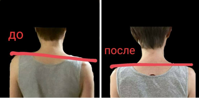 הישגים קטנים ...לפני ואחרי... :) image