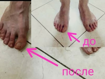 הישגים קטנים ...לפני ואחרי... :) image