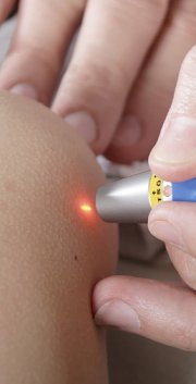 Lasertherapie image