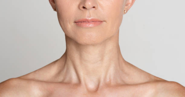 CREPEY NECK AND DÉCOLLETAGE