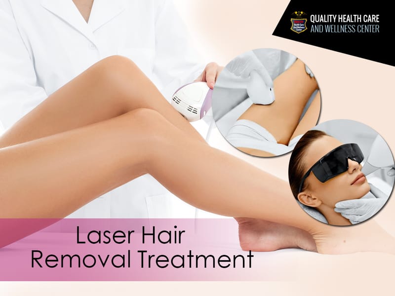 LASER HAIR REMOVAL