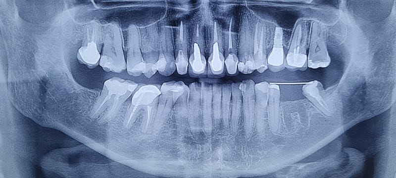 ODONTOLOGIA ONCOLÓGICA